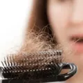 Tips Mengatasi Rambut Rontok dengan Cara Tepat