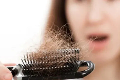 Tips Mengatasi Rambut Rontok dengan Cara Tepat