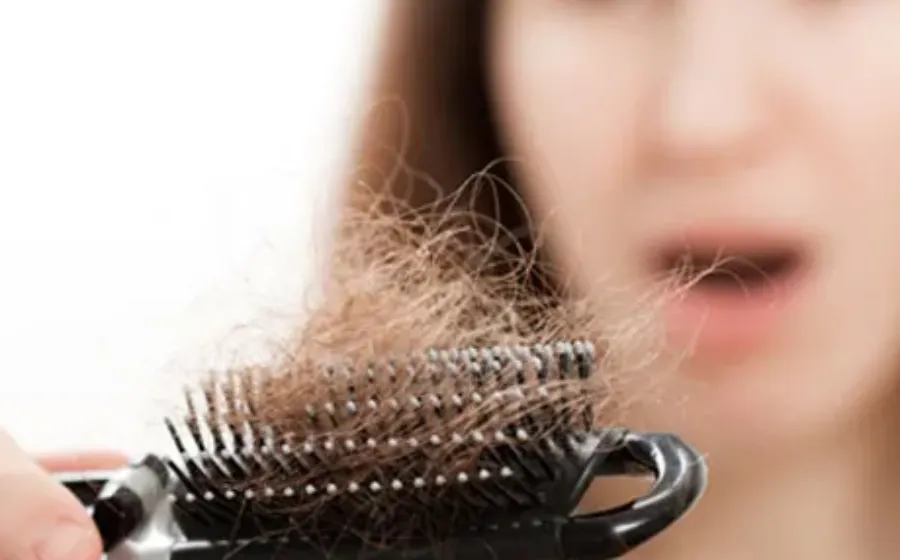 Tips Mengatasi Rambut Rontok dengan Cara Tepat