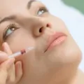 Cara Menghaluskan Kulit Wajah Dengan Suntik Botox