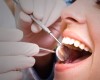 Pertimbangan Penting Sebelum Mencabut Gigi