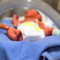 bayi prematur