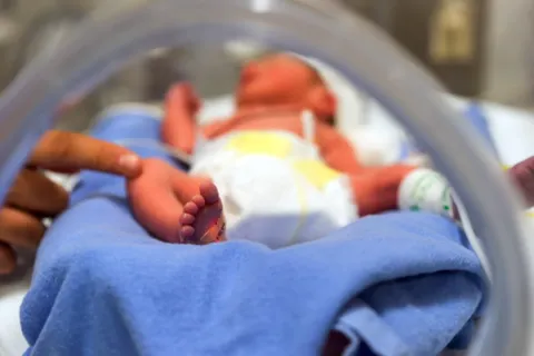 bayi prematur