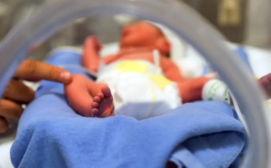 bayi prematur