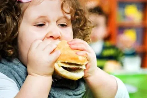 Cara Mencegah Obesitas Anak