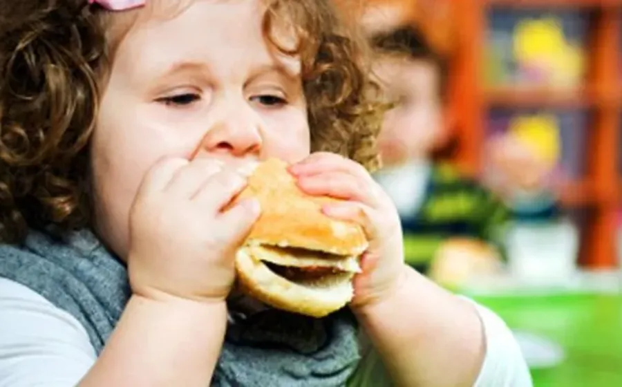 Cara Mencegah Obesitas Anak