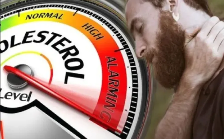 Kolesterol