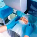 Mengenal LASIK Mata, Biaya, Prosedur, Manfaat dan Kandidat yang Cocok
